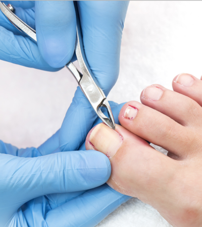 Podiatry home visits in Epsom