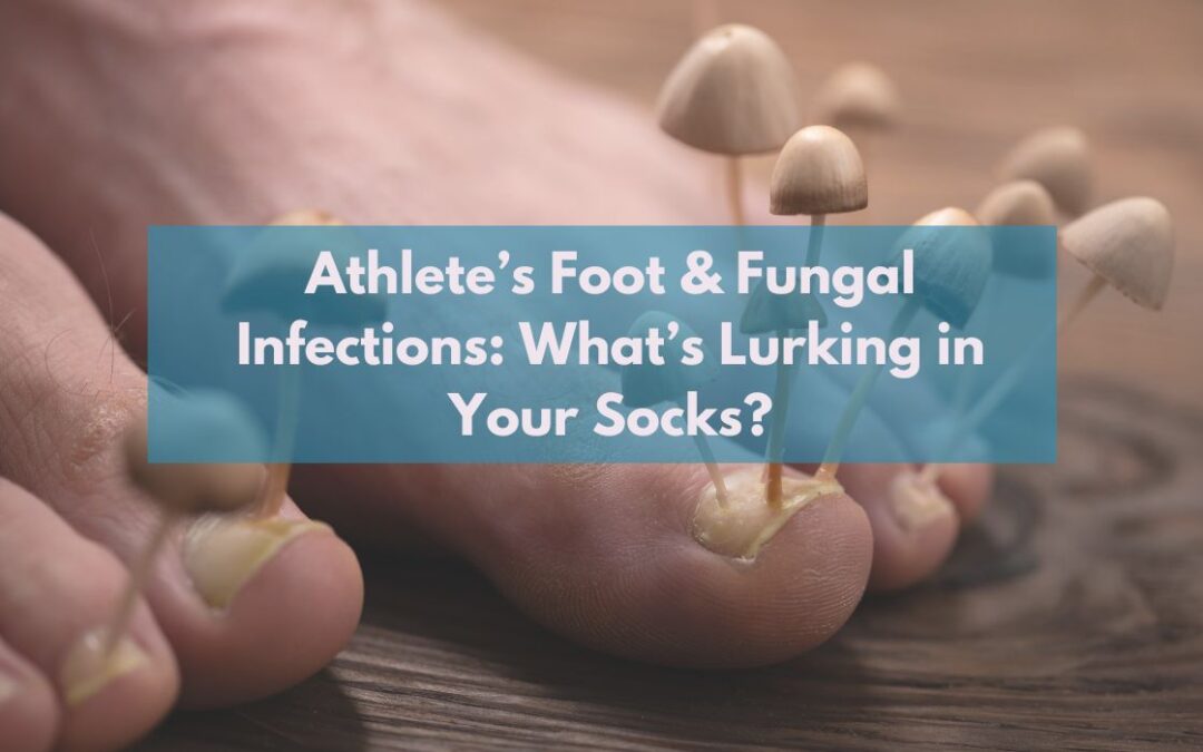 Athlete’s Foot & Fungal Infections: What’s Lurking in Your Socks?