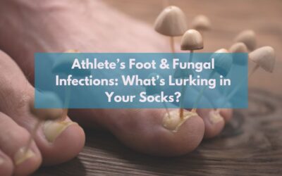 Athlete’s Foot & Fungal Infections: What’s Lurking in Your Socks?