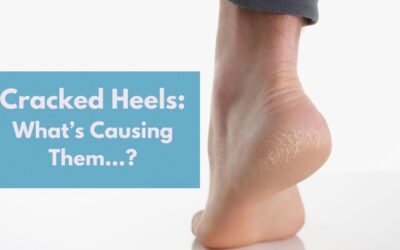 Cracked Heels: What’s Causing them…